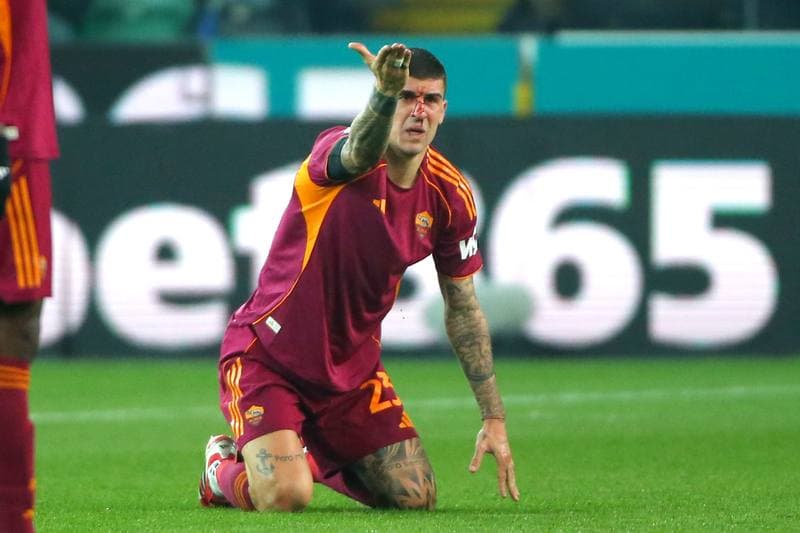 Football. Serie A. Udinese - AS Roma. 02.02.2026