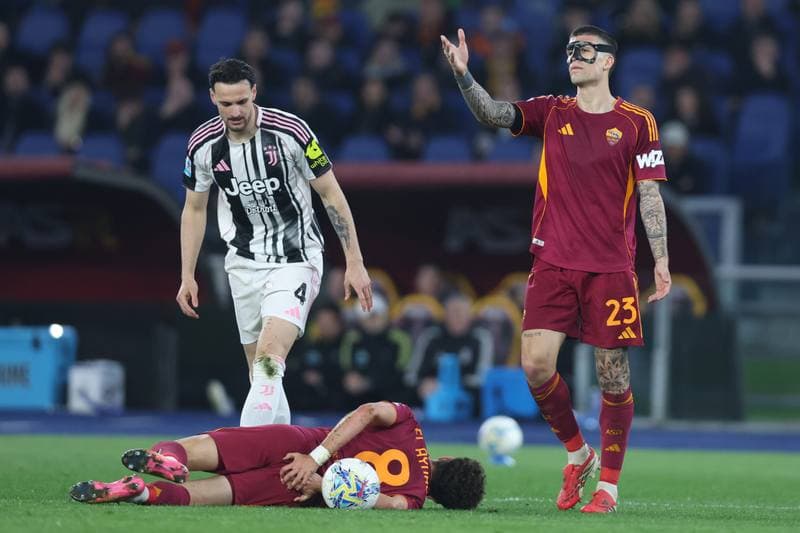 Football. Serie A. AS Roma - Juventus. 01.03.2026
