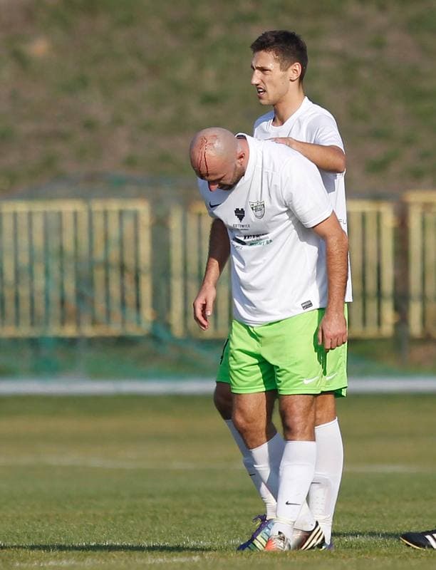 Football. I Liga. Rozwoj Katowice - Miedz Legnica. 31.10.2015